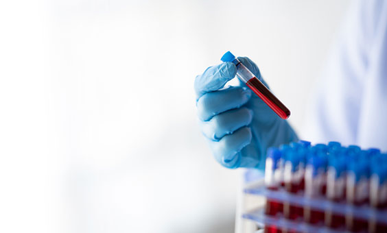 Haematology, Haemato-Oncology & Bone Marrow Transplantation (BMT)